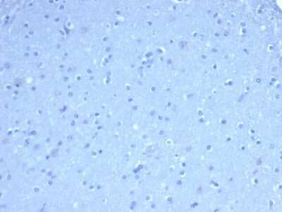 Immunohistochemistry-Paraffin: TOM1L1 Antibody (TOM1L1/4690) [NBP3-07136]
