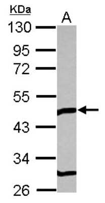 Western Blot: TOM1L1 Antibody [NBP2-20680]