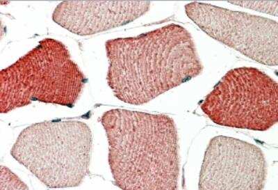 Immunohistochemistry-Paraffin: TOM1L2 Antibody [NB300-991]