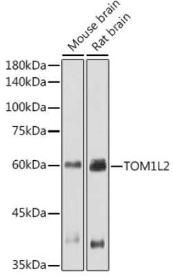 Western Blot: TOM1L2 AntibodyAzide and BSA Free [NBP3-16053]