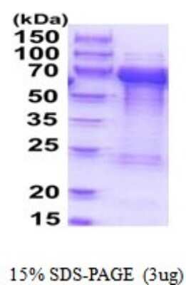 SDS-PAGE: Recombinant Human TOM1L2 His Protein [NBP2-52026]