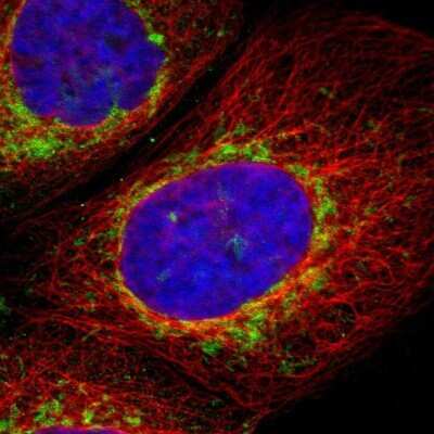 Immunocytochemistry/ Immunofluorescence: TOM70 Antibody [NBP1-87863]
