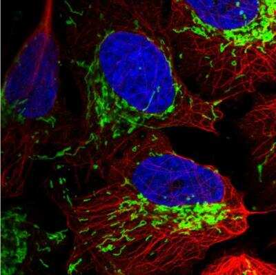Immunocytochemistry/ Immunofluorescence: TOM70 Antibody [NBP2-38571]