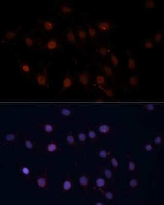 Immunocytochemistry/ Immunofluorescence: TOM70 Antibody - Azide and BSA Free [NBP2-94889]