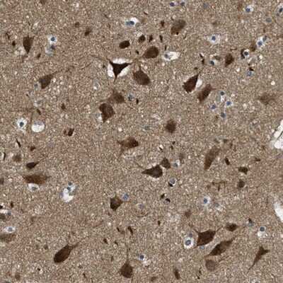 Immunohistochemistry-Paraffin: TOM70 Antibody [NBP1-87863]