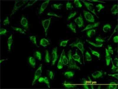 Immunocytochemistry/ Immunofluorescence: TOMM20 Antibody (4F3) [H00009804-M01]