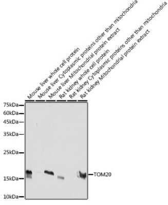Western Blot: TOMM20 Antibody (10G6I8) [NBP3-15750]