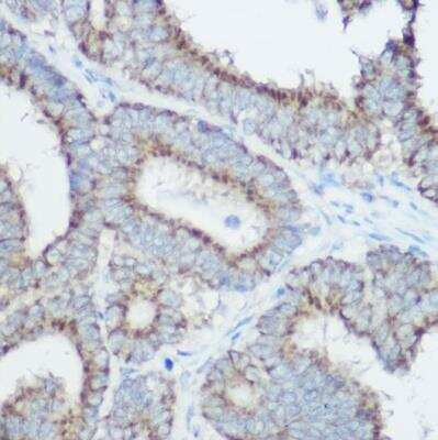 Immunohistochemistry-Paraffin: TOMM20 Antibody - Azide and BSA Free [NBP2-94821]