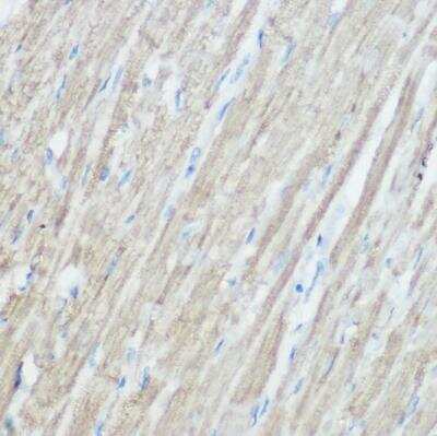Immunohistochemistry-Paraffin: TOMM20 Antibody - Azide and BSA Free [NBP2-94821]