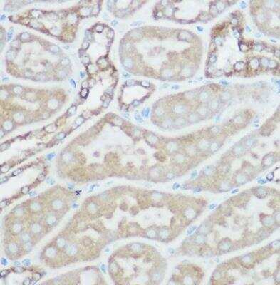 Immunohistochemistry-Paraffin: TOMM20 Antibody - Azide and BSA Free [NBP2-94821]