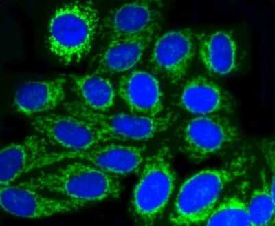 Immunocytochemistry/ Immunofluorescence: TOMM20 Antibody (ST04-72) [NBP2-67501]