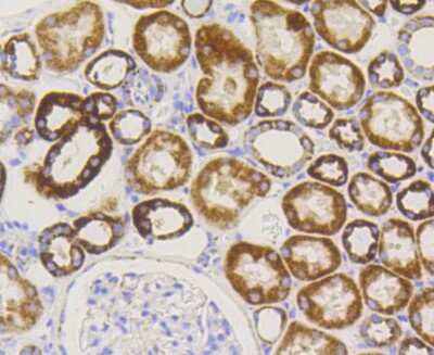 Immunohistochemistry-Paraffin: TOMM20 Antibody (ST04-72) [NBP2-67501]