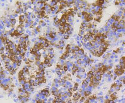 Immunohistochemistry-Paraffin: TOMM20 Antibody (ST04-72) [NBP2-67501]