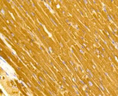 Immunohistochemistry-Paraffin: TOMM20 Antibody (ST04-72) [NBP2-67501]