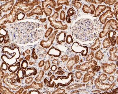 Immunohistochemistry-Paraffin: TOMM20 Antibody (ST04-72) [NBP2-67501]