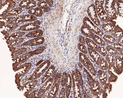 Immunohistochemistry-Paraffin: TOMM20 Antibody (ST04-72) [NBP2-67501]