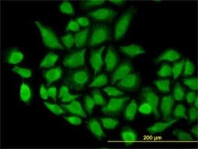 Immunocytochemistry/ Immunofluorescence: TOMM22 Antibody (4G4) [H00056993-M01]