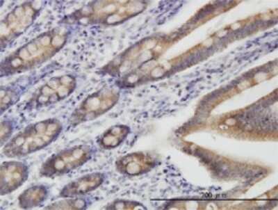 Immunohistochemistry-Paraffin: TOMM22 Antibody (4G4) [H00056993-M01]