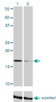 Western Blot: TOMM22 Antibody (4G4) [H00056993-M01]