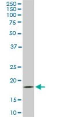Western Blot: TOMM22 Antibody (4G4) [H00056993-M01]
