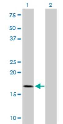Western Blot: TOMM22 Antibody (4G4) [H00056993-M01]