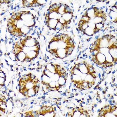 Immunohistochemistry-Paraffin: TOMM22 Antibody (6R1L7) [NBP3-16856]