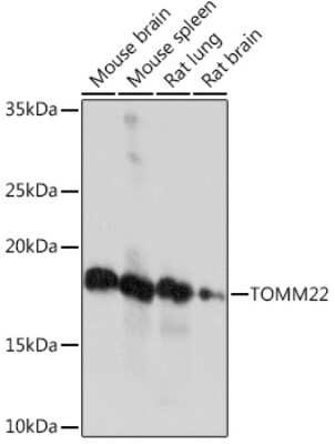 Western Blot: TOMM22 Antibody (6R1L7) [NBP3-16856]