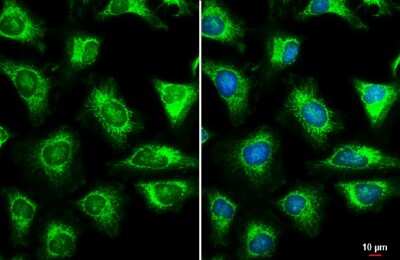 Immunocytochemistry/ Immunofluorescence: TOMM22 Antibody [NBP3-13415]