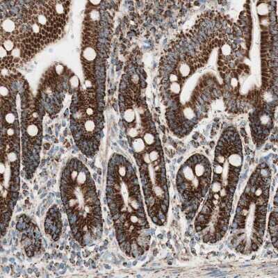 Immunohistochemistry-Paraffin: TOMM22 Antibody [NBP1-80671]