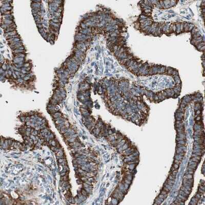 Immunohistochemistry-Paraffin: TOMM22 Antibody [NBP1-80671]