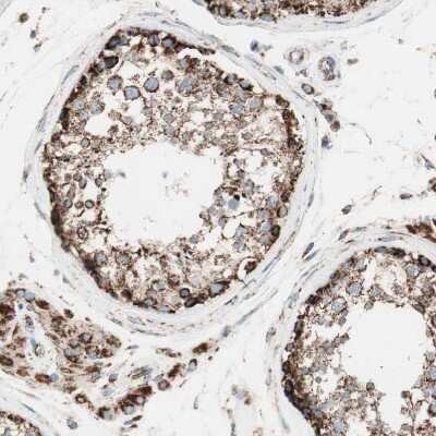 Immunohistochemistry-Paraffin: TOMM22 Antibody [NBP1-80671]