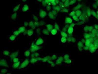 Immunocytochemistry/ Immunofluorescence: TOMM34 Antibody (OTI2A9) [NBP2-00892]