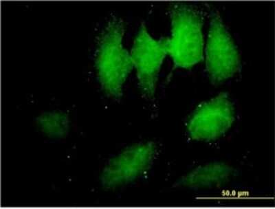 Immunocytochemistry/ Immunofluorescence: TOMM34 Antibody (2B5) [H00010953-M01]