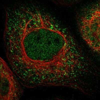 Immunocytochemistry/ Immunofluorescence: TOMM34 Antibody [NBP1-81655]