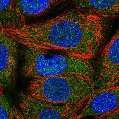 Immunocytochemistry/ Immunofluorescence: TOMM34 Antibody [NBP2-38810]