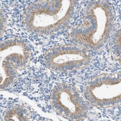 Immunohistochemistry-Paraffin: TOMM34 Antibody [NBP1-81655]