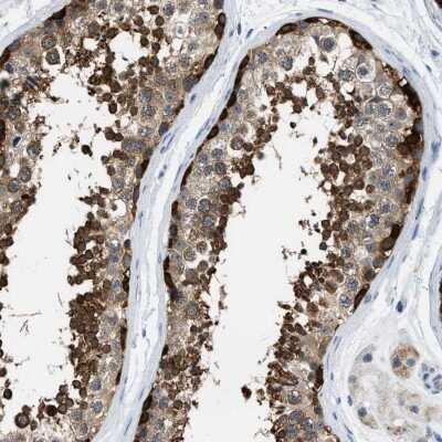 Immunohistochemistry-Paraffin: TOMM34 Antibody [NBP1-81655]