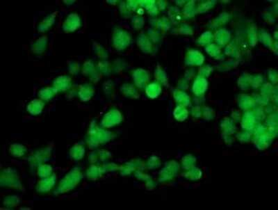 Immunocytochemistry/ Immunofluorescence: TOMM34 Antibody (OTI2A9) - Azide and BSA Free [NBP2-74550]