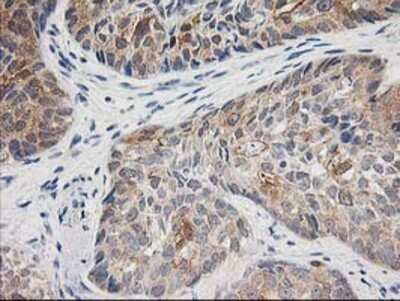 Immunohistochemistry: TOMM34 Antibody (OTI2A9) - Azide and BSA Free [NBP2-74550]