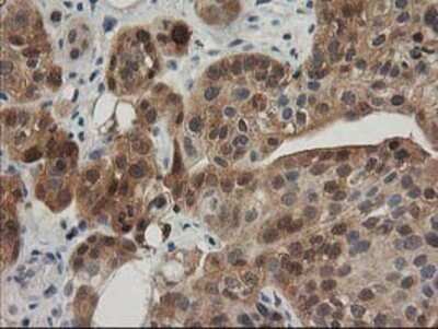 Immunohistochemistry: TOMM34 Antibody (OTI2A9) - Azide and BSA Free [NBP2-74550]