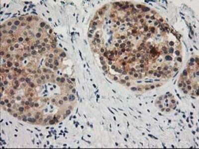 Immunohistochemistry: TOMM34 Antibody (OTI2A9) - Azide and BSA Free [NBP2-74550]