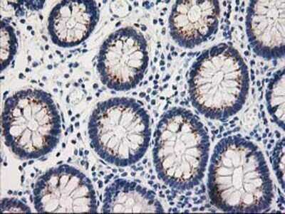 Immunohistochemistry: TOMM34 Antibody (OTI2A9) - Azide and BSA Free [NBP2-74550]