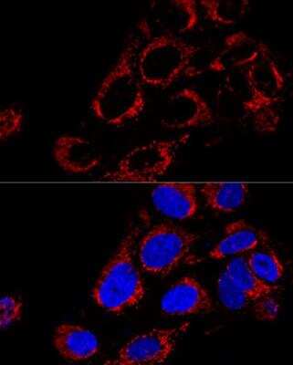 Immunocytochemistry/ Immunofluorescence: TOMM40 Antibody - Azide and BSA Free [NBP2-94075]