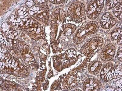 Immunohistochemistry-Paraffin: TOMM40 Antibody [NBP3-13293]