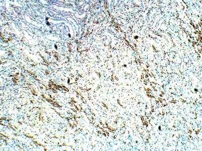 Immunohistochemistry-Paraffin: TOMM5 Antibody [NBP3-12358]