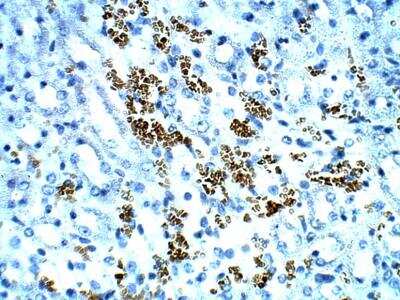 Immunohistochemistry-Paraffin: TOMM5 Antibody [NBP3-12358]