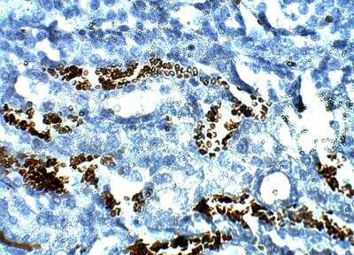 Immunohistochemistry-Paraffin: TOMM5 Antibody [NBP3-12358]