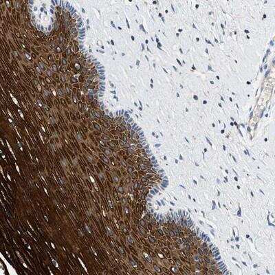 Immunohistochemistry-Paraffin: TOMM6 Antibody [NBP1-90688]