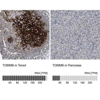 Immunohistochemistry-Paraffin: TOMM6 Antibody [NBP1-90688]