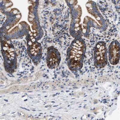 Immunohistochemistry-Paraffin: TOMM6 Antibody [NBP1-90688]